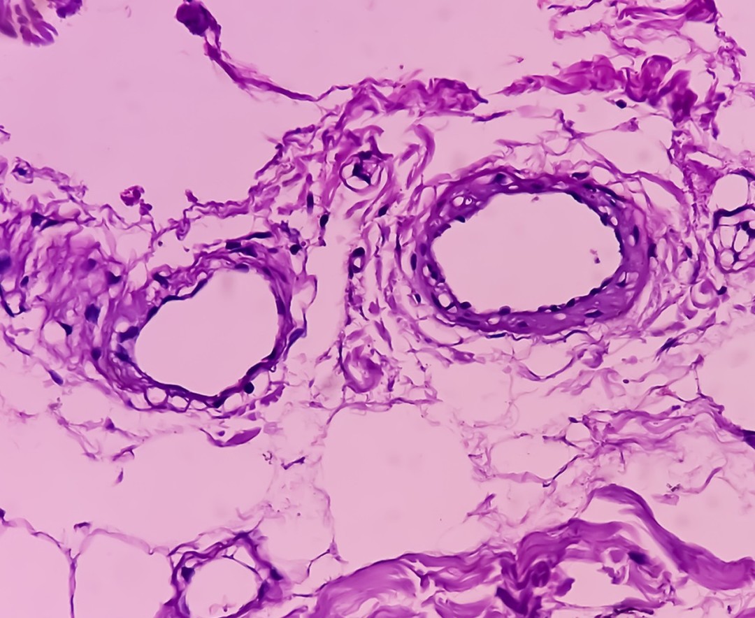 crop,h_884,w_1080,x_0,y_0